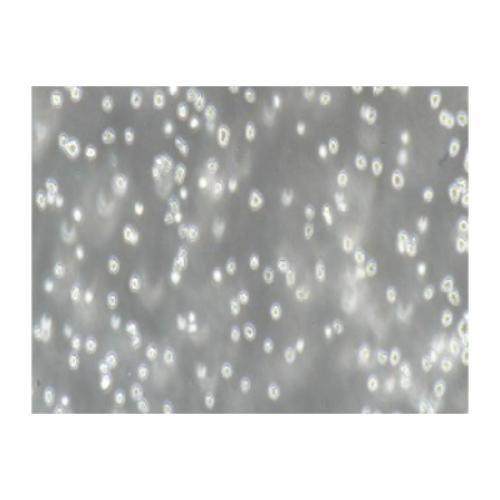 Human Anterior B Acute Lymphoblastic Leukemia Cell Line, #NALM-6