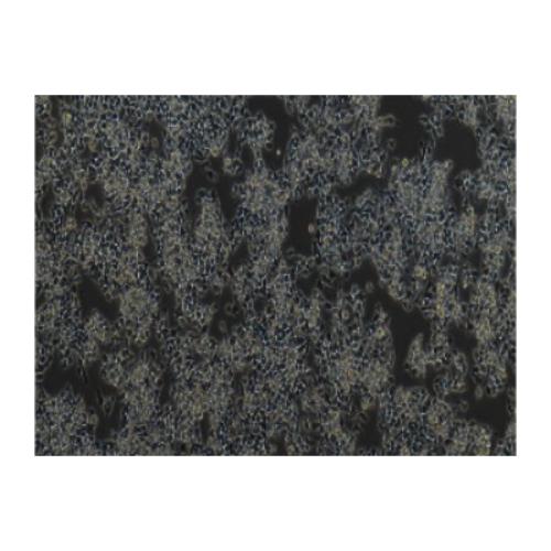 Human Colorectal Adenocarcinoma Cell Line, #LS174T