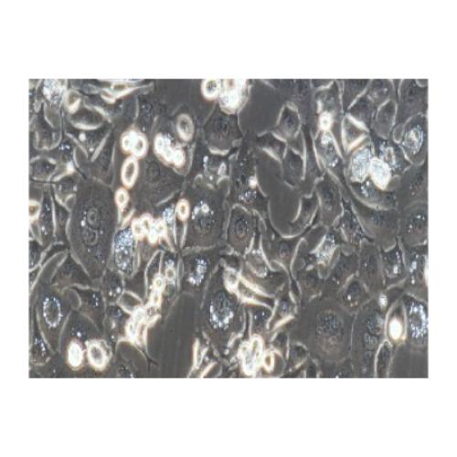 Human Esophageal Cancer Cell Line, #KYSE-30