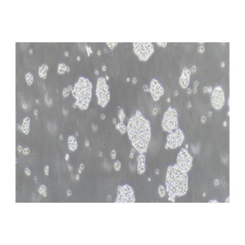Human T-Lymphocytic Leukemia Cell Line, #JURKAT(CLONE E6-1)