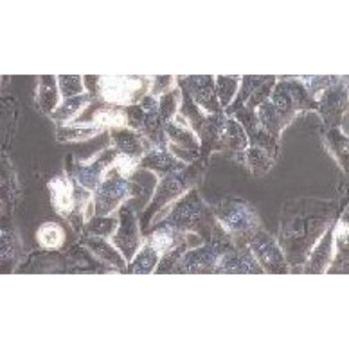Human Cervical Carcinoma Cell, #BT-B