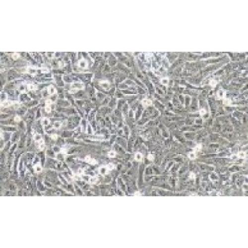 Human Osteosarcoma Cell Line, #143B