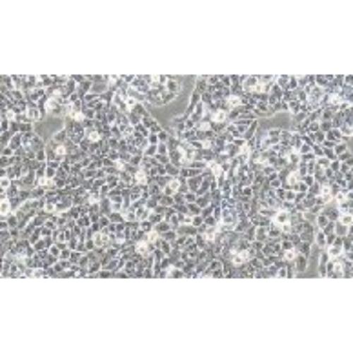 Colon Cancer Cell Line, #CX-1