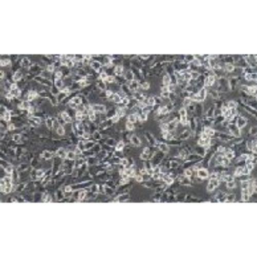 Human Pancreatic Cancer Cell Line, #PATU8988S