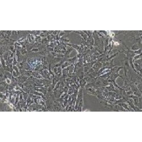 Human Cholangiocyte-Type Hepatoma Cell Line, #HCCC-9810