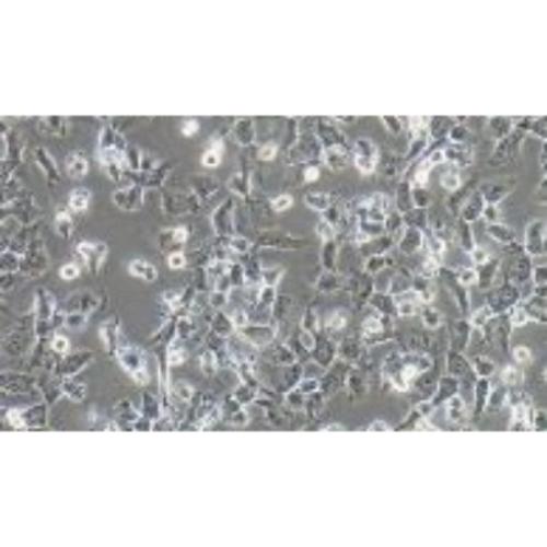 Human Invasive Choroidal Melanoma Cell Line, #MUM2B