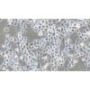 Human Lung Cancer Cell Line, #PC-9