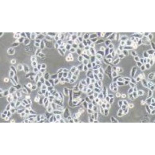 Human Lung Cancer Cell Line, #PC-9