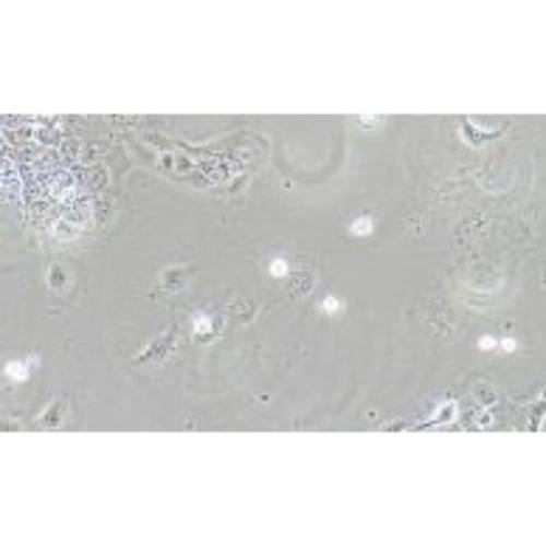 Human Bladder-Squamous Carcinoma Cell Line, #SCABER