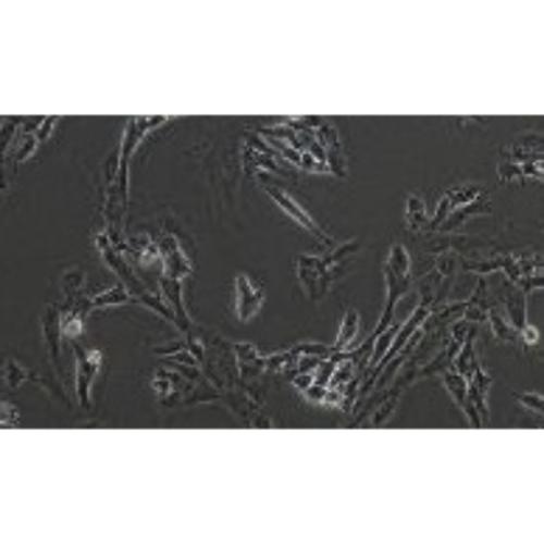 Human Synovial Sarcoma Cell Line, #SW982 [SW-982]