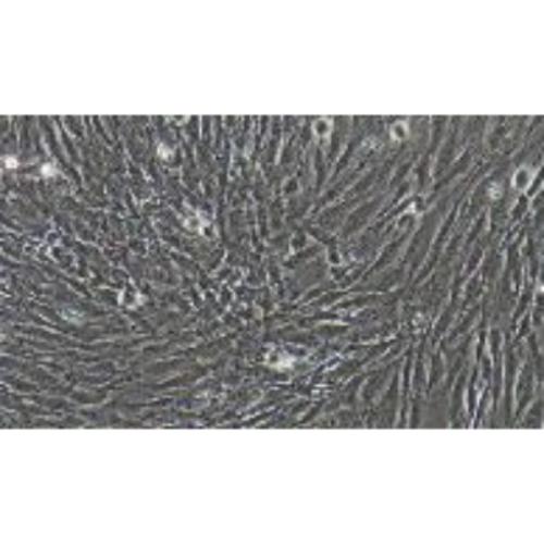 Human Dermal Fibroblasts (Immortalized In Primary Cell Line), #HSF(SV40)