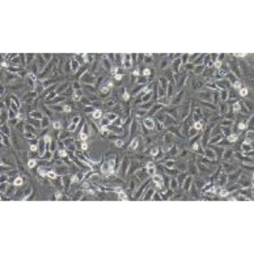 Human Lung Cancer Cell Line, Luciferase Labeled #A549+LUC