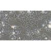 Colon Cancer Cell Line, #CX-1