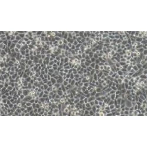 LUCiferase Labeling In Human Cervical Cancer Cell Line, #HELA+LUC