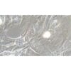 Immortalized Cell Line Of The Human Normal Prostate Stroma, #WPMY-1