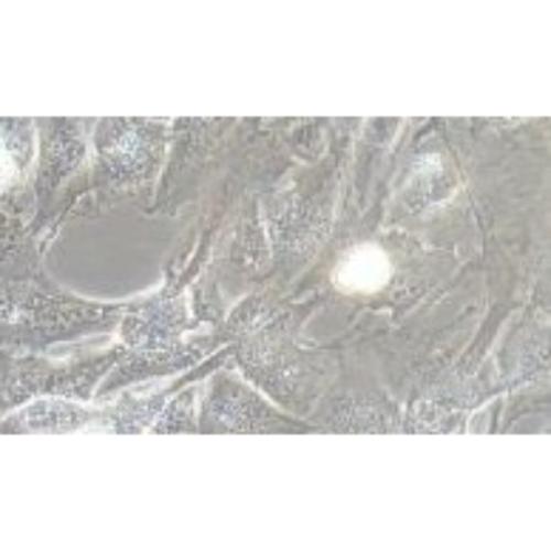 Immortalized Cell Line Of The Human Normal Prostate Stroma, #WPMY-1