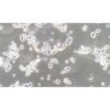 Human Neuroretinal Glioma Cell Line, #WERI-RB-1
