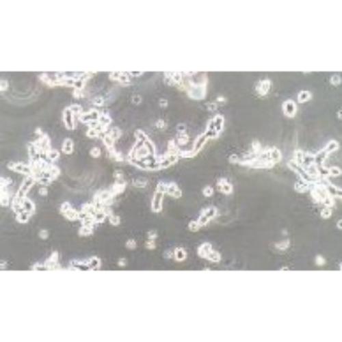 Human Neuroretinal Glioma Cell Line, #WERI-RB-1