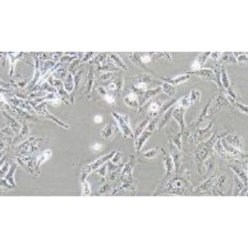 Human Osteosarcoma Cell Line, #U-2 OS