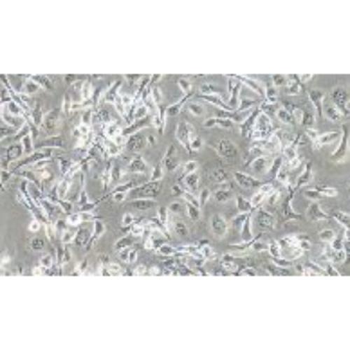 Human Esophageal Cancer Cell Line, #TE-1