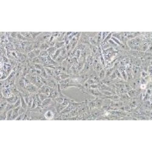 Human Glioblastoma, #T98G