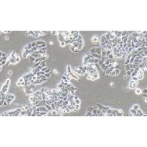 Human Breast Ductal Cancer Cell Line, #T47D