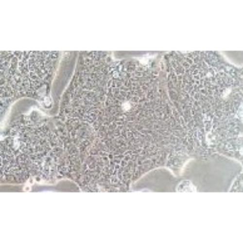 Human Colonic Adenocarcinoma Cell Line, #SW1116