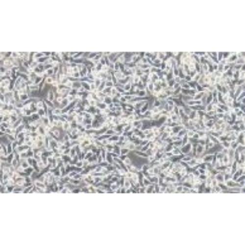 Human Colorectal Adenocarcinoma Cell Line, #SW620