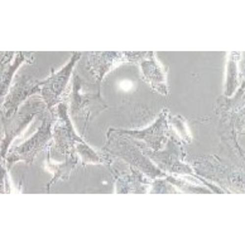 Human Thyroid Cancer Cell Line, #SW579