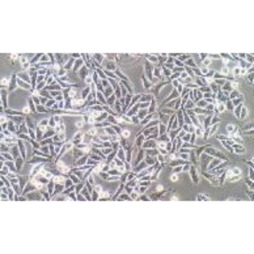 Human Colonic Adenocarcinoma Cell Line, #SW480