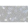 Human Glioma, #SNB-19