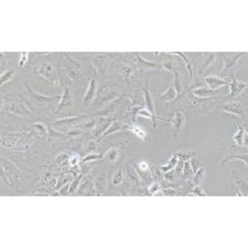 Human Ovarian Cancer Cell Line, #SK-OV-3