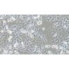 Human Cutaneous Melanoma Cell Line, #SK-MEL-2