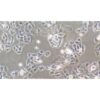 Human Small Cell Lung Cancer (Not Available), #SBC-2