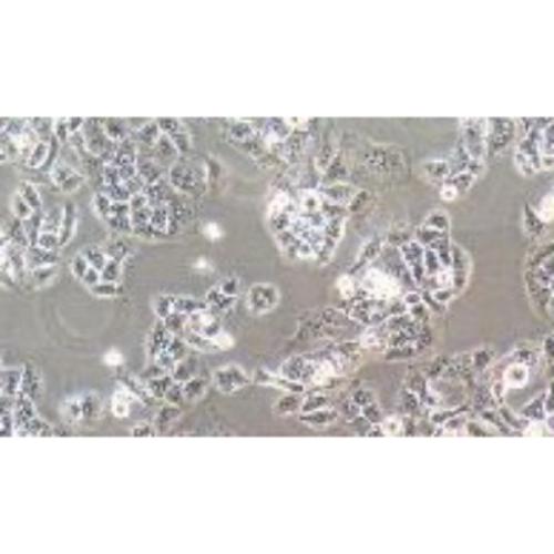 Human Small Cell Lung Cancer (Not Available), #SBC-2