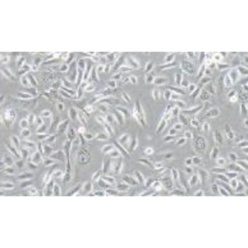 Normal Cell Line Of The Human Prostate Gland, #RWPE-2