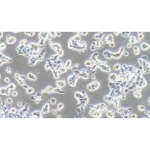 Human Endometrial Cancer Cell Line, #RL95-2