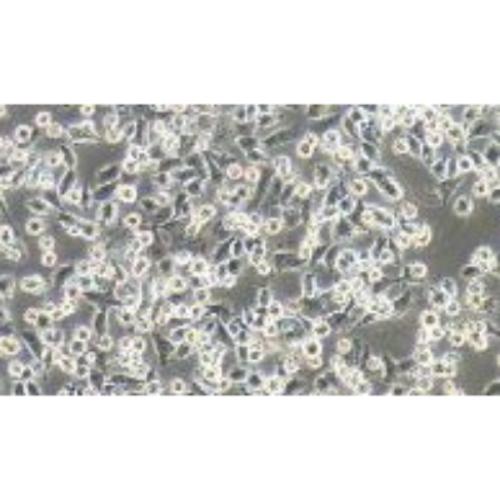 Human Pancreatic Cancer Cell Line, #PATU8988T(PATU8988)