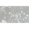 Human Non-Small-Cell Lung Cancer Cell Line, #NCI-H1299