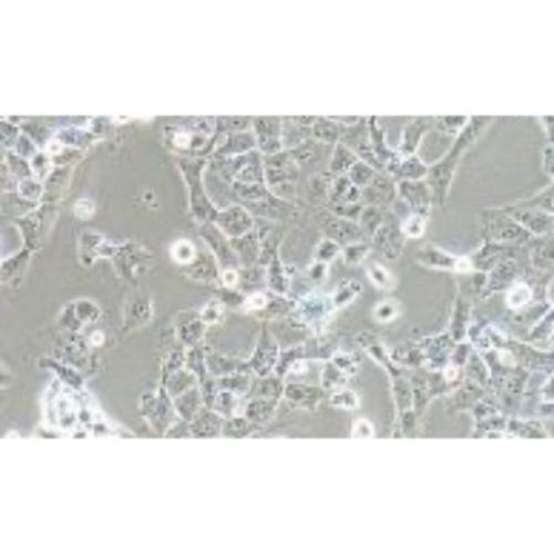 Human Non-Small-Cell Lung Cancer Cell Line, #NCI-H1299