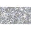 Human Melanoma Cell Line, #MDA-MB-435S