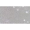 Human Breast Cancer Cell, #HS578T