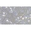 Human Cervical Carcinoma Cell, #AV3