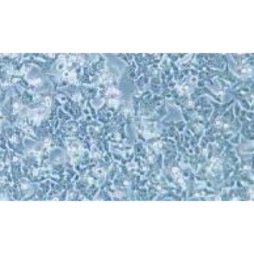 Human Bladder Cancer Cell Line, #BIU-87