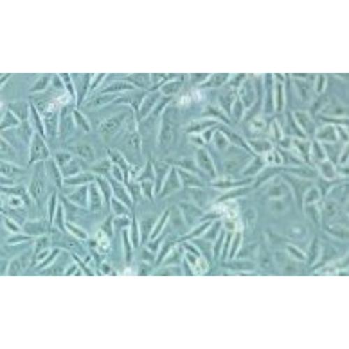 Human Bladder Cancer Cell Line, #EJ-1[EJ1]