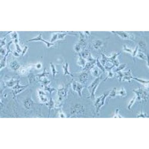 Human Gastric Carcinoma Cell, #HS746T