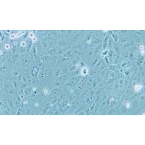 Human Cholangiocarcinoma Cell Line, #HUCCT1