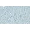 Granulosa Cell Tumour Cell Line Of The Human Ovary, #KGN