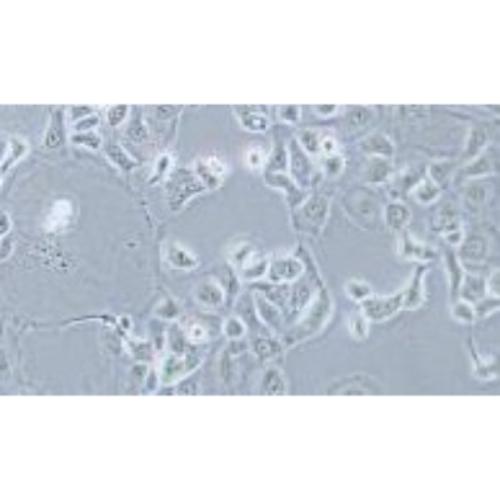 Human Endometrial Cancer Cell Line, #KLE