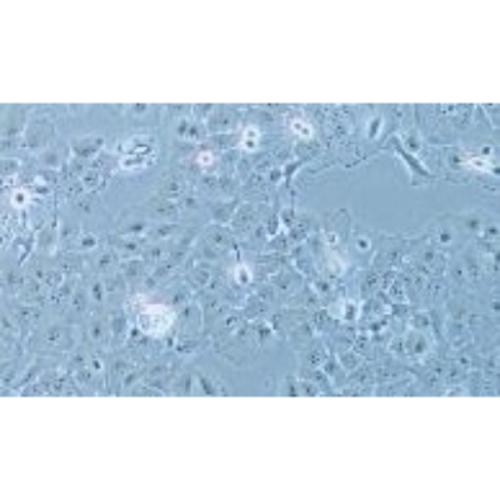 Human Oesophageal Squamous Carcinoma Cell Line, #KYSE-150